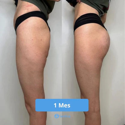 ElevaGluteos — Realza y Firmeza sin esfuerzo