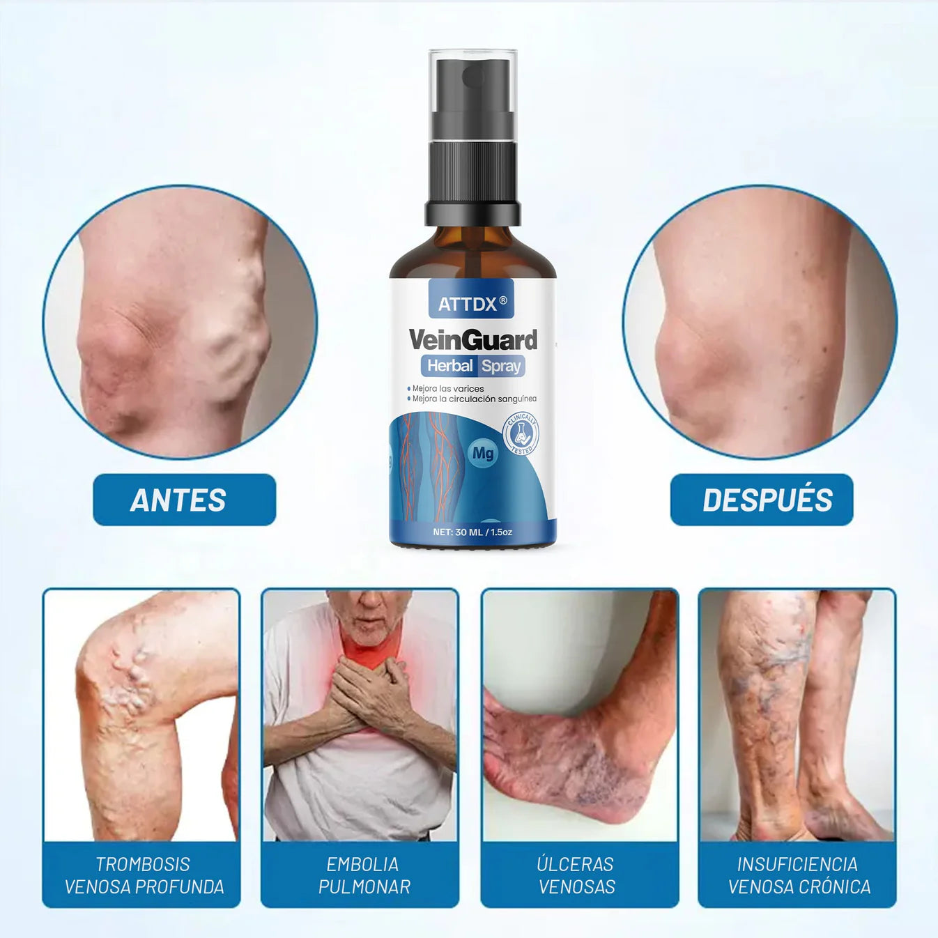 VEINGUARD Herbal Spray 2x1! | Desinflama y Mejora la Circulación